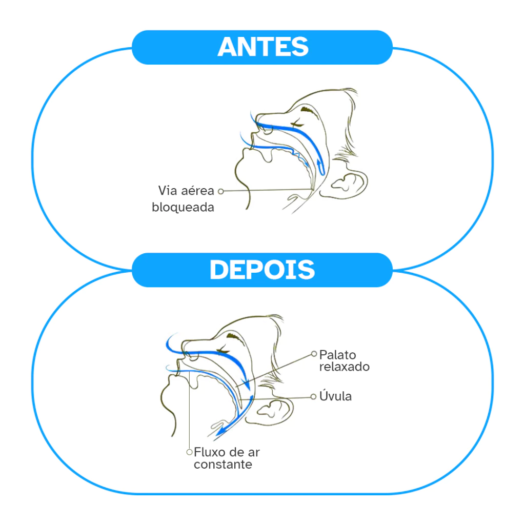 Detalhe do material de silicone moldável